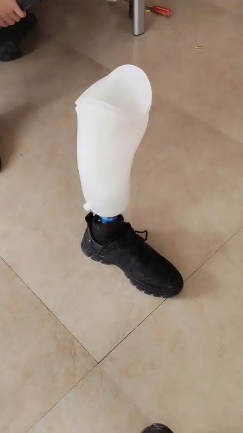 洛阳的大哥,小腿假肢,这样的接受腔,上口比较低,坐下不顶裤子,非常