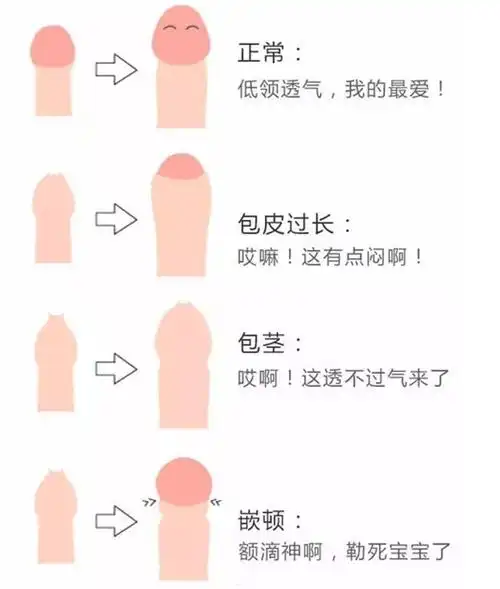 到底什么情况下孩子需要割包皮,小男孩几岁割包皮合适,手术会不会对