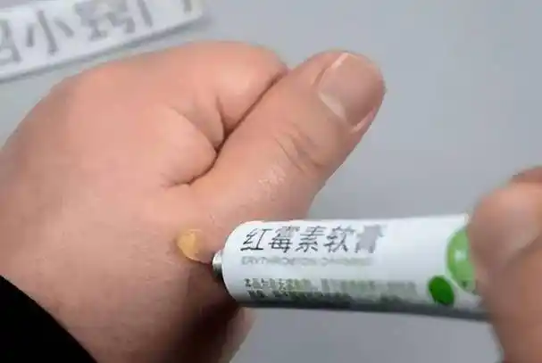 原创3块钱一支的红霉素软膏可以治疗多少种病这4个作用很突出