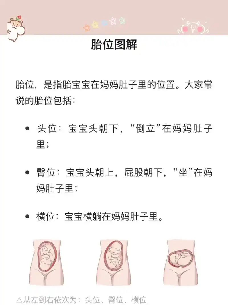 哪种胎位最适合顺产?胎位有20多种,有些适合顺产,有的却只能 - 抖音