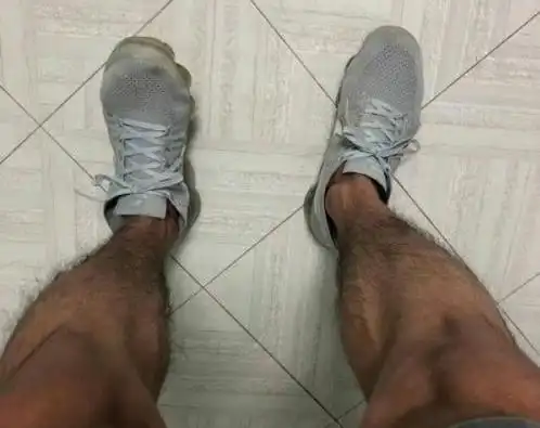 有的男性腿毛稀少有的却很旺盛其原因有2个别不好意思