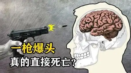 一枪爆头真的直接死亡?子弹飞进脑壳之后,发生了啥?