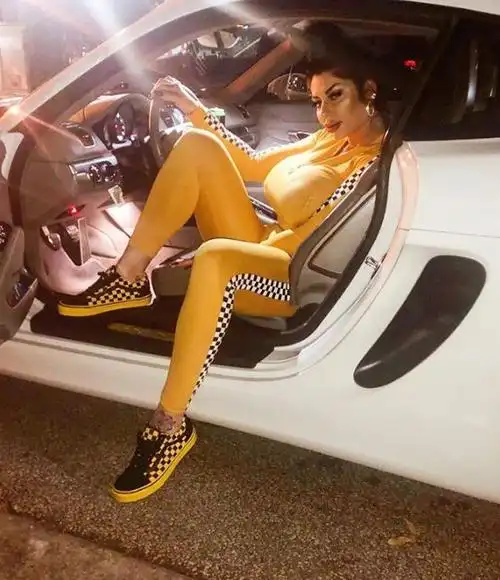 lindi的家人很支持她的事业,但不希望她做太多整容手术,lindi说:"曾有