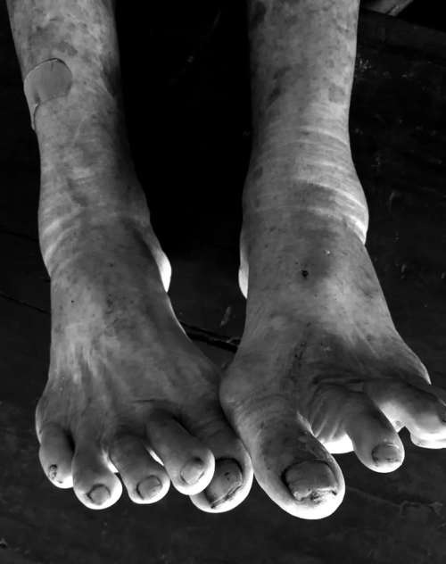 海南102岁大脚高龄老人仍每天自己洗衣砍椰子