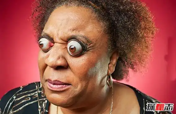 世界上最奇异的10个女人第十整容成怪物第一堪比吸血鬼