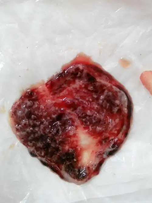 停经51天了 中午上厕所的时候下掉的一块东西 请问这是什么 是流产了