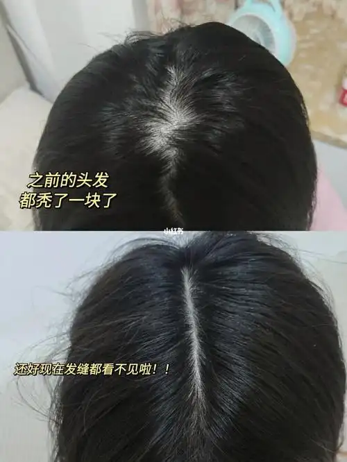 洗发水_脱发_防脱发_防脱_改善头皮_黑发_护发_生姜_防脱发洗发水_美