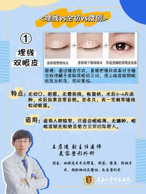 埋线vs全切vs微创三种双眼皮手术方式科普