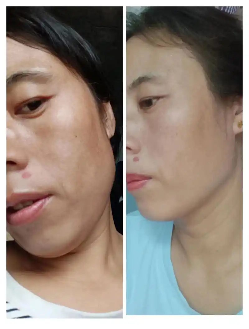 哇塞我自己喝了两瓶焕颜膏皮肤变白了好多呀