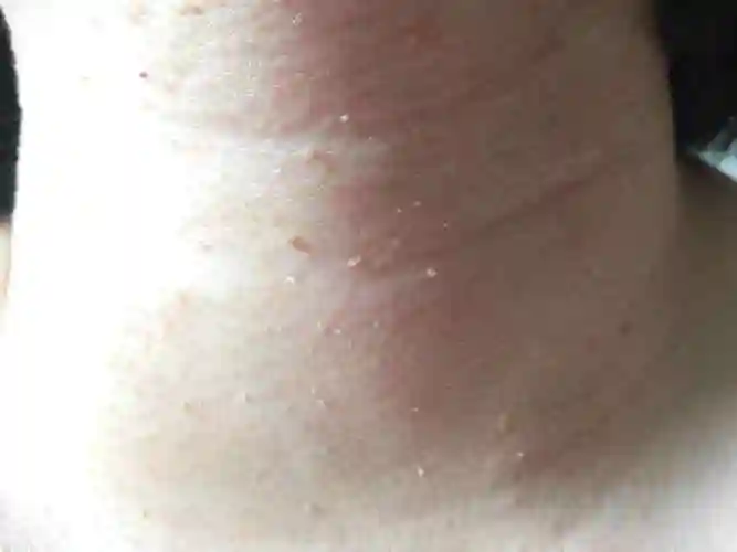 腋下长了一个小疙瘩是什么东西腋下有个包一按有点疼