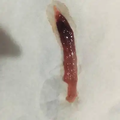 11月1日腹部疼痛伴有流血,就医说先兆流产,开了保胎药,打了保胎针