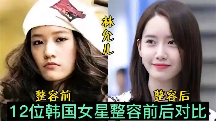 12位韩国女星整容前后对比泫雅判若两人朴敏英堪称整容模板