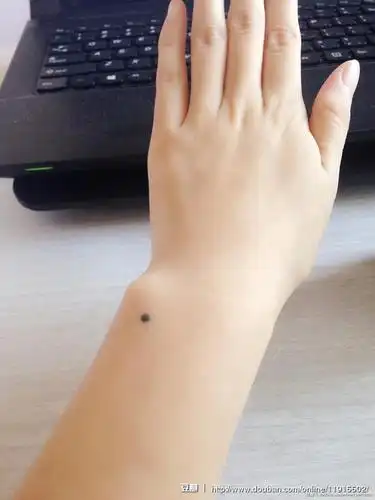 左手手腕处                 来自 挥着辣条的女孩