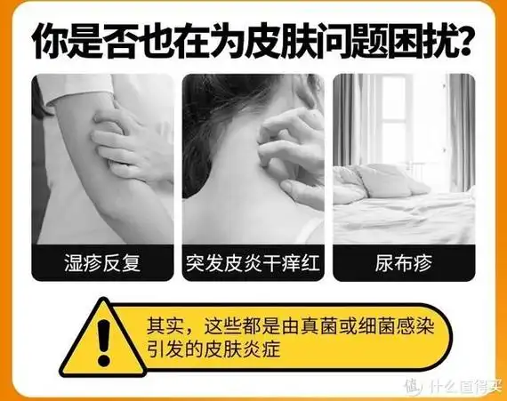 曲安奈德 益康唑齐俩兄弟齐上阵,派瑞松止痒更治痒|湿疹|细菌_新浪