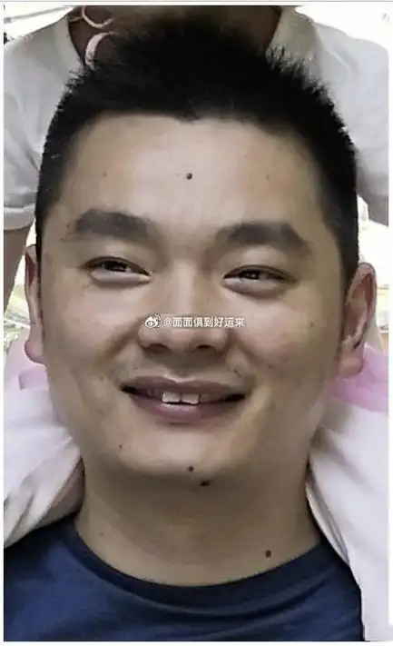 脸上痣很明显,事业宫处生有痣,加上颧骨有痣,事业发展容易多挫折和