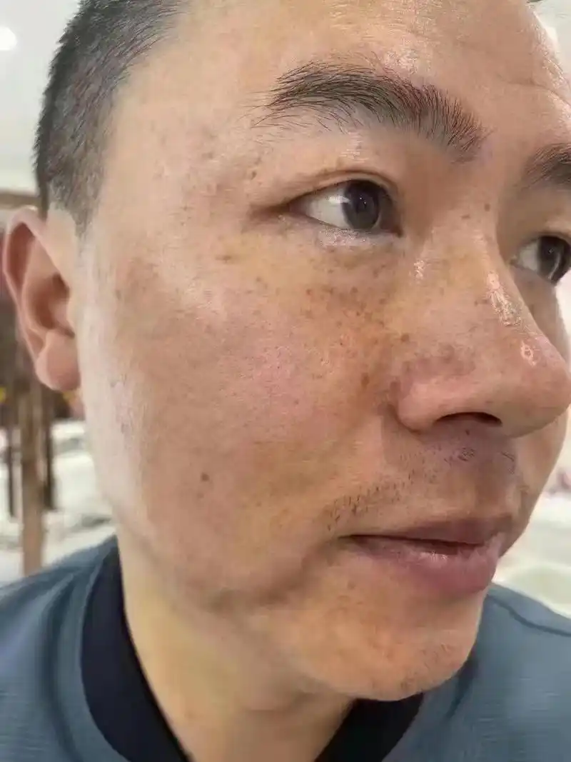 自用好物分享 #提亮肤色改善暗沉 #解决任何皮肤问题  - 抖音