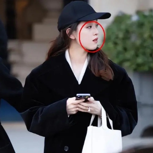 牙齿凸出地包天严重,穿着4万名牌难掩眼里的泪光_黑色_大衣_造型