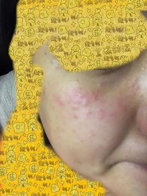 也不像痘痘也不像湿疹.不知道是什么东西.不痛不痒.这是怎么回事