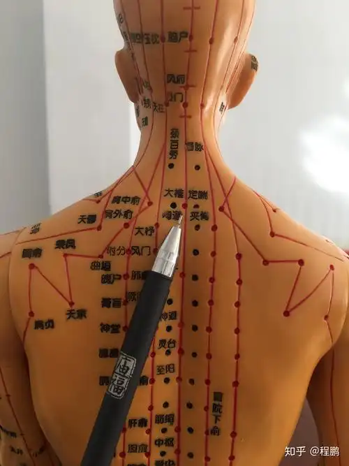 拔罐调理高血压穴位 - 知乎