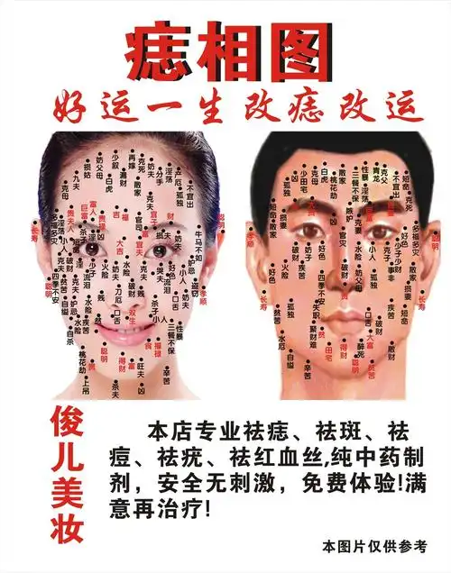 男人面部痣相图解 大富大贵男子痣相图