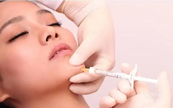打玻尿酸丰下巴效果自然吗