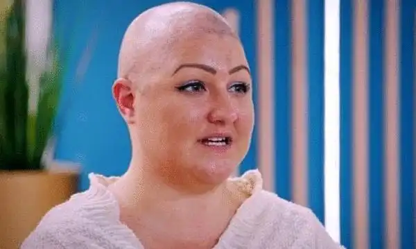 英国28岁女子患拔毛症 拔光自己的头发用鞋油掩盖