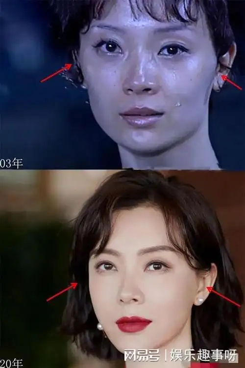 8位换头改命的女明星黄奕脸蛋已僵硬杨颖靠换头爆红