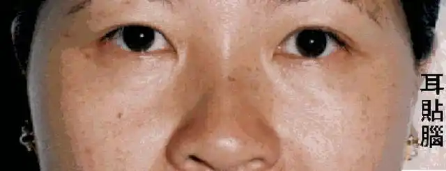 面相术耳朵的面相术好耳朵能百事吉祥富贵福寿