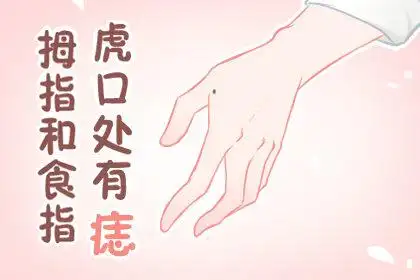拇指和食指虎口处有痣 代表什么
