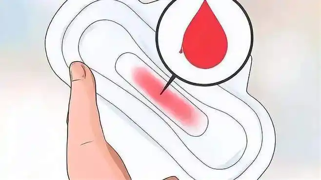 非月经期间有褐色的分泌物是怎么回事?