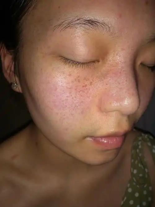 肉眼看得到的那种哦,皮肤也变得更加白皙了,祛斑霜是比较温和的,不