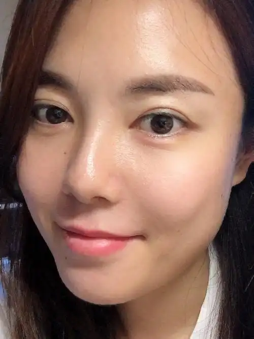 【胶原蛋白微针】皮肤细腻又弹润,给你真正少女肌!