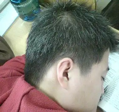 究竟有什么办法对付早生的白发?