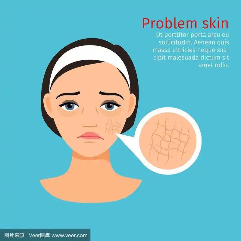 女性面临皮肤干燥问题