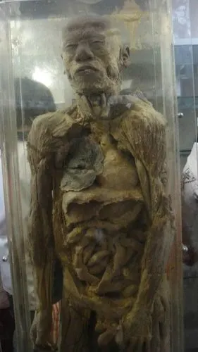 海宁卫校尸体标本图