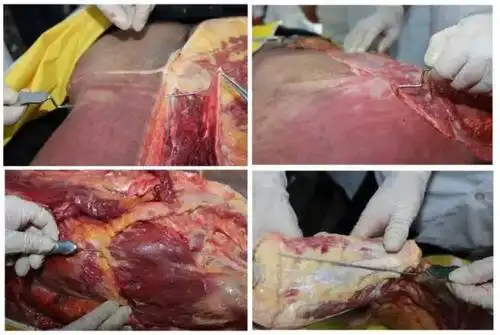 没有解剖学就没有医学2019年1月12日全国第十一届深圳新鲜尸体解剖班