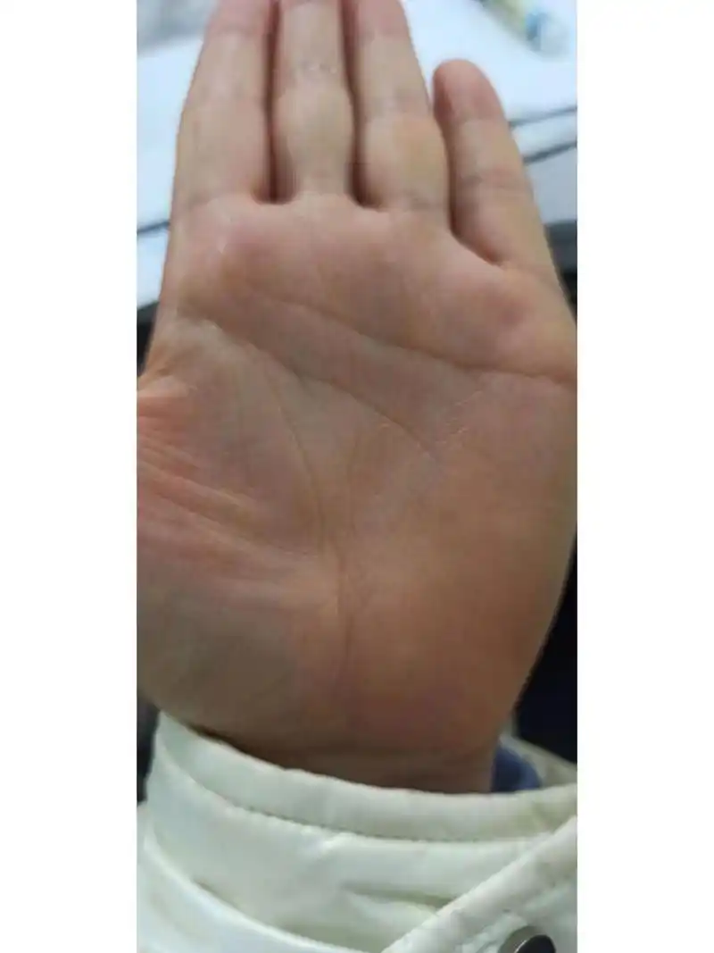 手相 双手生命线都短 分叉 短点 完蛋了 两只手生命线都短,一只手短