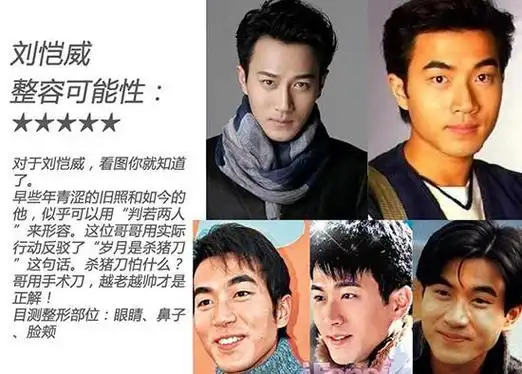 金秀贤李敏镐金宇彬林峰当红男星整容大猜测