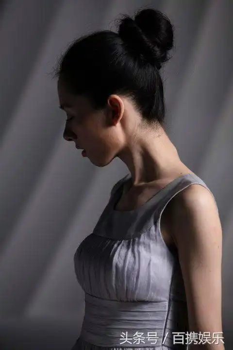 郭碧婷不是离不开黑长直而是自己整牙整成下巴后缩才变丑