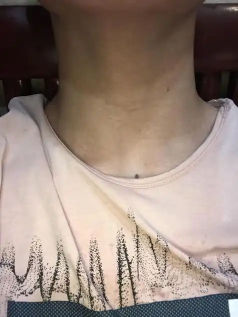 摸男生喉结意味着什么 我是19岁的男生,发现我的喉结特别大,比同龄人