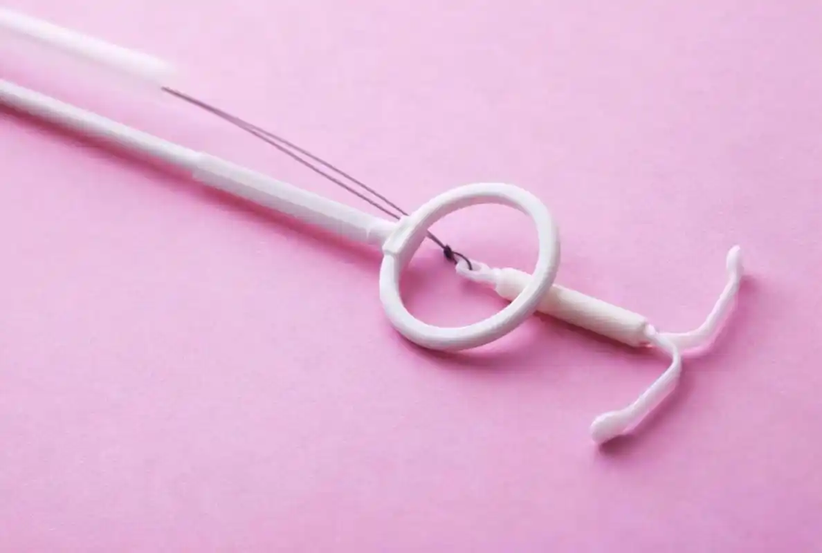 国内第一批上环女性的现状,很多都不乐观,可能会有这几种结局