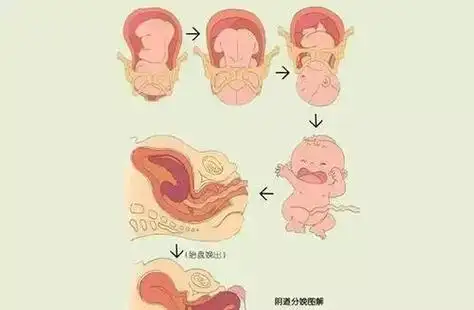 胎儿出生多久胎盘出来(胎儿出生后胎盘多久娩出)