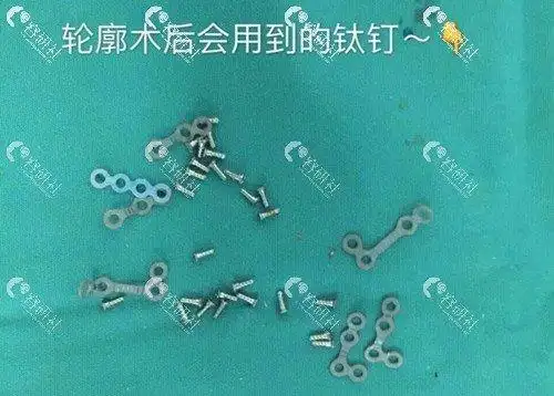 轮廓手术中使用的钛钉