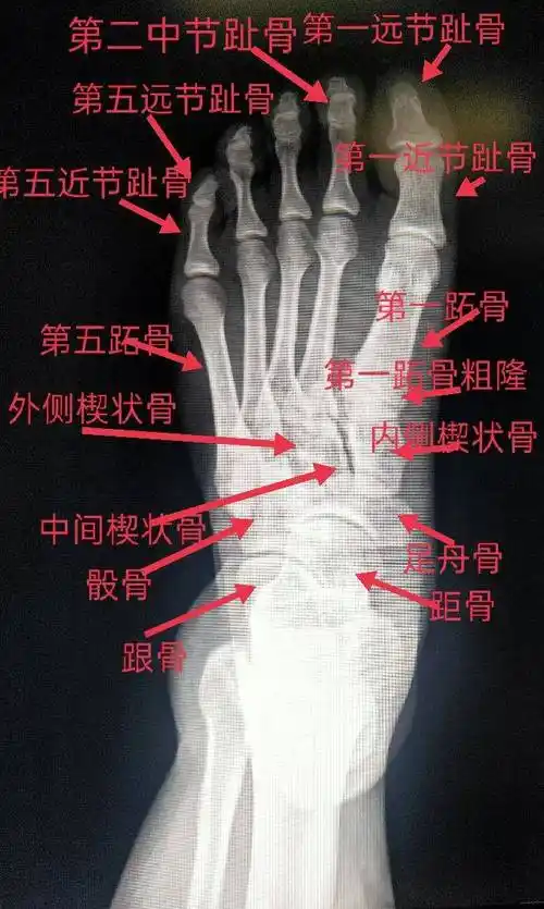 趾骨是哪个位置足跖骨怎么描述