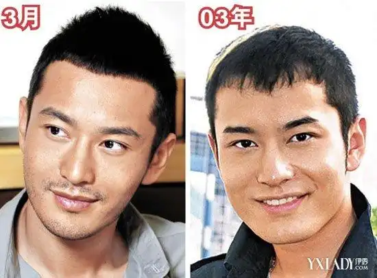 黄晓明整容前后照片对比"肉脸照"曝光