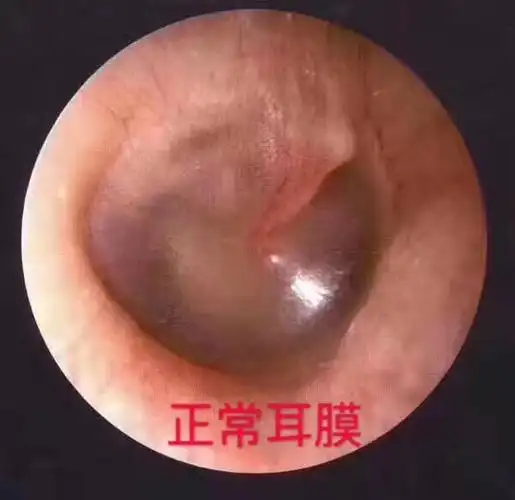 陈老师收集各种耳朵图片