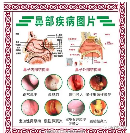 99元享受价值129元鼻腔检查三次治疗