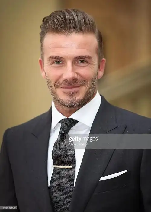 世界第一帅的贝克汉姆也开始植发了,英国人的秃头基因究竟有多强大