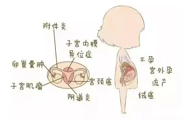 一张"女性妇科疾病"地图,揭示女性不同阶段的生理特点!