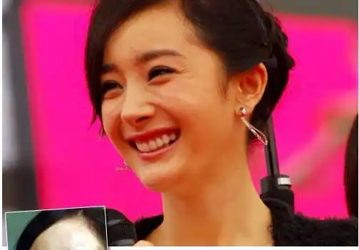 郑爽的牙齿又歪了?为什么明星的整牙效果也不好?